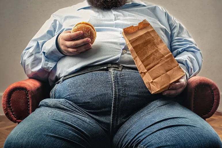 παχυσαρκία τι είναι